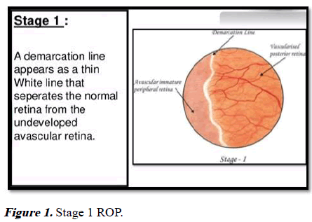 aajcp-Stage 1